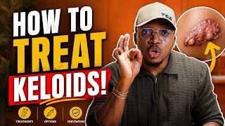 How to treat keloids! 