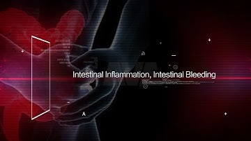 AVE-562 Fully Automated Feces Analyzer