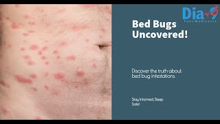 Bed Bugs Exposed! Don't Sleep Until You Watch This!