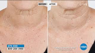 PRAI Ageless Neck Line Eraser BOGO