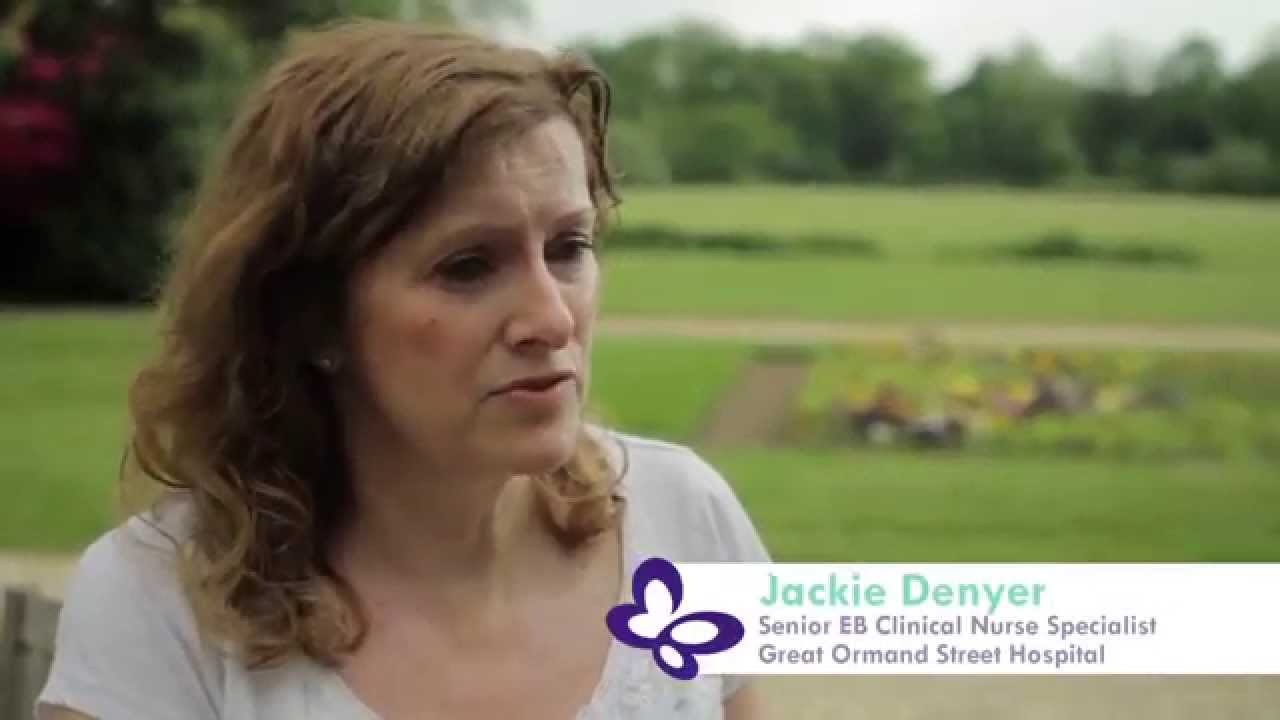 What is EB? - YouTube