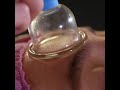 Остеопатический массаж лица #shorts