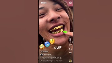 Thumbnail of Her gold teeth popping or nah?!.