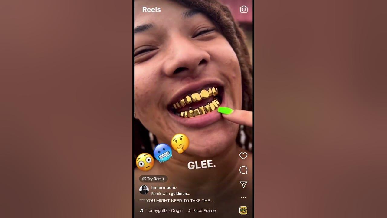 Her gold teeth popping or nah?!.