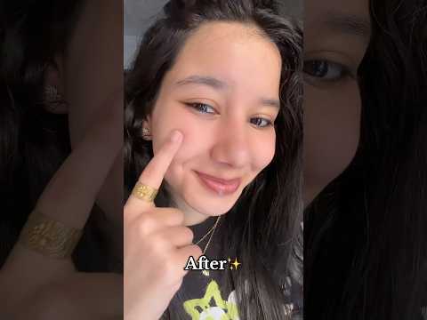 حولت بشرتي تمام بعد الامتحانات في عشر ايام بس  اكسبلور  