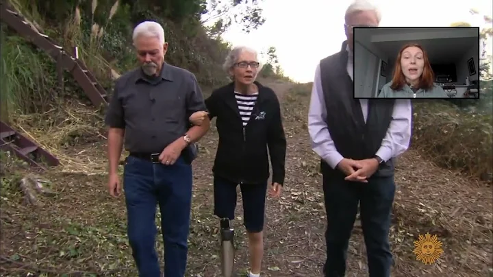 A Giant Step Forward in Artificial Legs