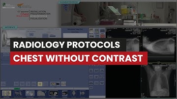 Computed Tomography Protocol Step-by-Step Guide: Chest CT Without Contrast