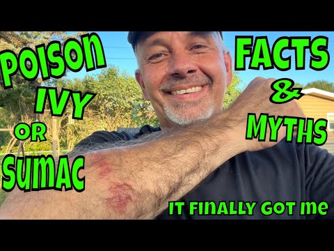 Video: Poison Oak Rash & Hunder