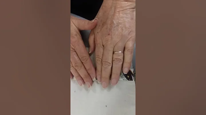 Easy way to sew a sleeve House Placket