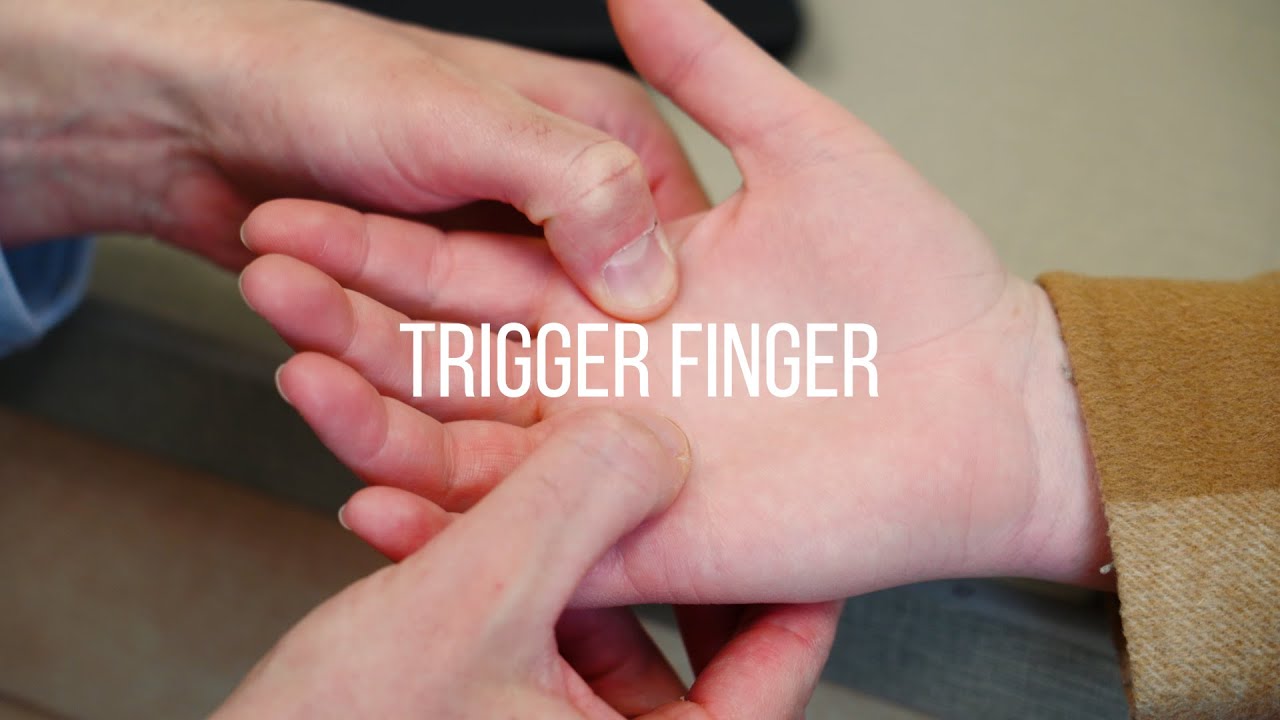 What is Trigger Finger, and What Can I Do About It?