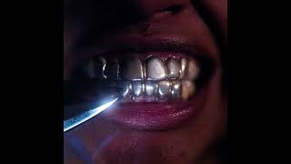 Upchuck - Forgotten Token