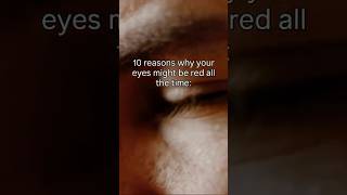 Why your eyes might be red all the time.