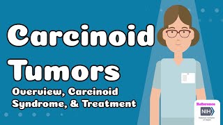 Carcinoid Tumors - Overview, Carcinoid Syndrome &amp; Treatment