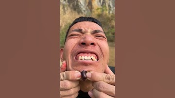 How I Cured a Bug Bite with Yogurt in the Wild |😬😔🤠🙆‍♂️ Survival Hacks #345 #shorts #skincare