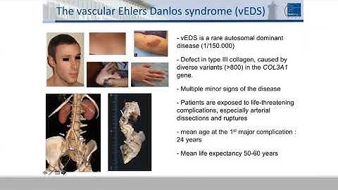 ABCs of VEDS (August 27, 2020) E3 Summit