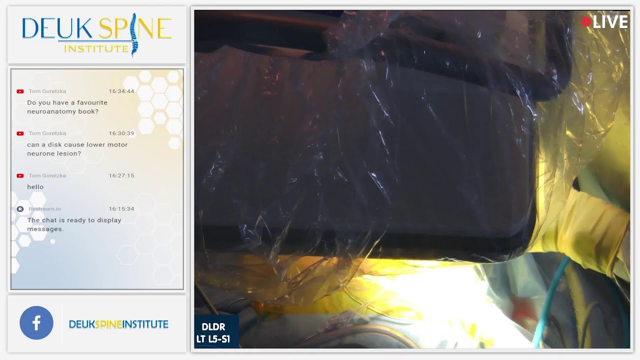 Watch Live Spine Surgery! Deuk Laser Disc Repair! LT L5S1 YouTube