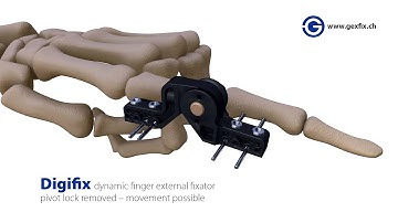 Gexfix - 3D animations