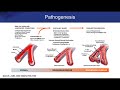 Pulmonary Arterial Hypertension: Addressing Diagnostic and Therapeutic Challenges