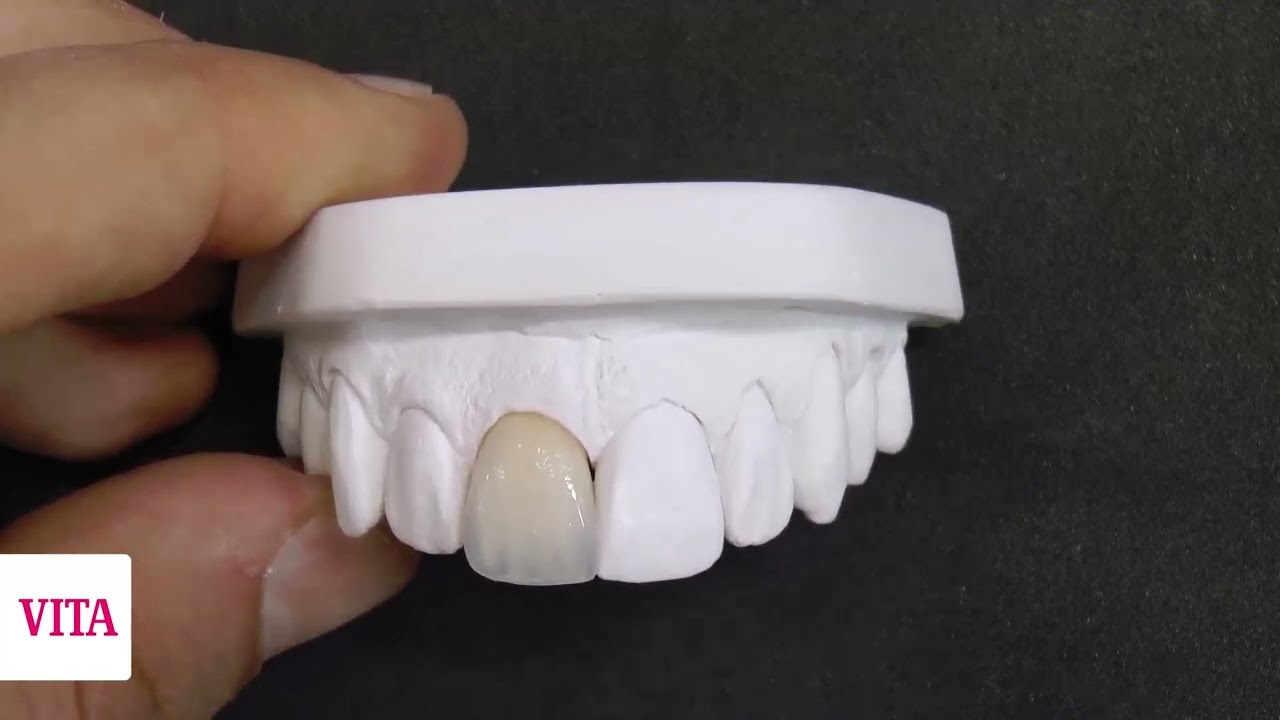 VITA LUMEX AC® GLASUR