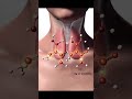Thyroid function #metabolism #easy #lifeisbutadream #music