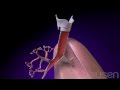 Bronchitis animation