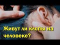 Живут ли клопы на человеке?