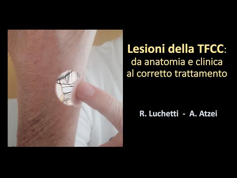 Lesioni della TFCC: da anatomia e clinica al corretto trattamento