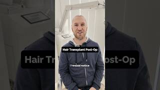 Hair Transplant Chat
