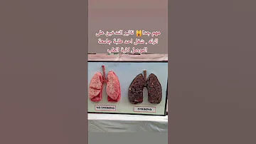 انتبهو من الدخان الناس تحسبه رجوله ياولد انا دخن يول امها ياجماعه ترا الدخان مضرررر وبس سلام عليكم 