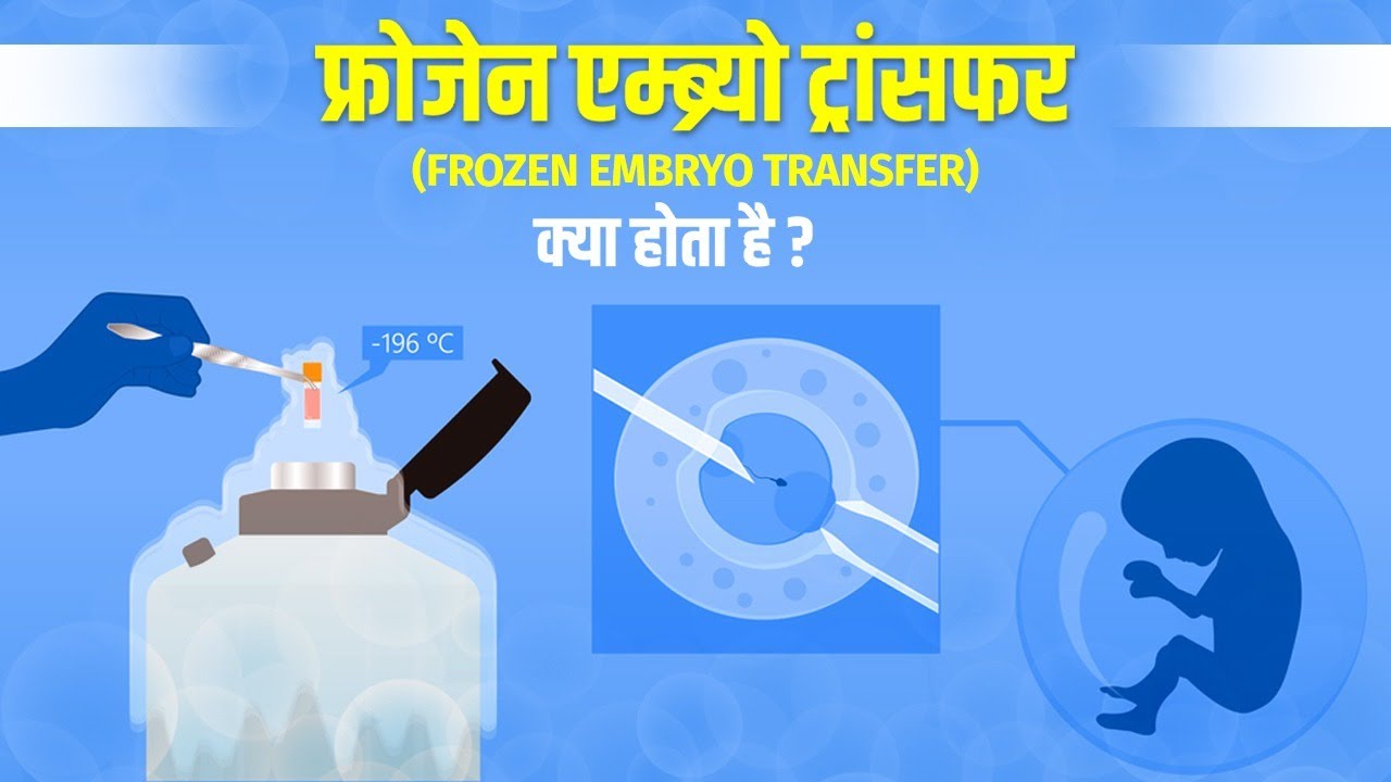 फ्रोजेन एम्ब्र्यो ट्रांसफर क्या होता है?, Frozen Embryo Transfer (FET