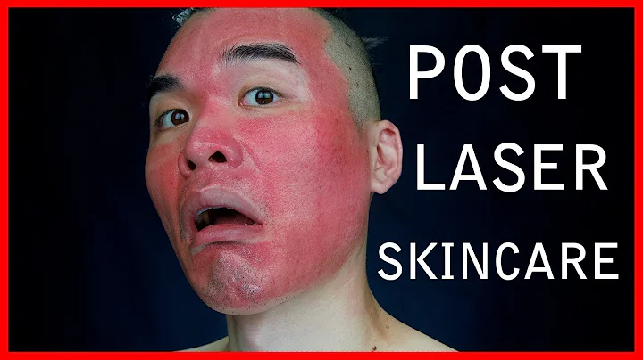 What to do after Pixel & Fraxel Laser | How to take care of your NEW skin!!!