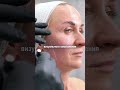Как создаётся визуальное омоложение? #лифтинглица