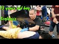 Master Chris Leong CLM Tit Tar Treatment for the 13 years old boy - Scoliosis