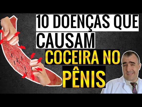 10 causas de COCEIRA NO PÊNIS!!!