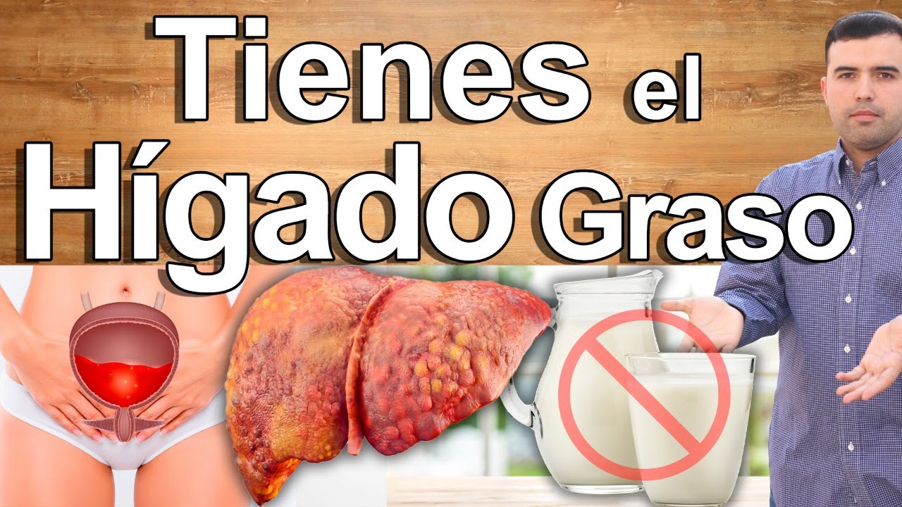 Tienes El Hígado Graso Y No Lo Sabes Recupera Y Cura Tu Hígado Tienes El Hígado Graso Y No Lo Sabes Recupera Y Cura Tu Hígado
