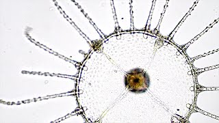 The Microscopic Life of Venice. What lives in the Canals?