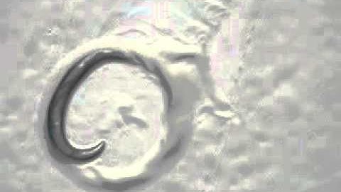 C. elegans rol-1 mutant　（線虫：rol-1変異体）