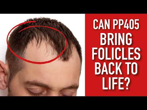Is PP405 a miracle cure for baldness?