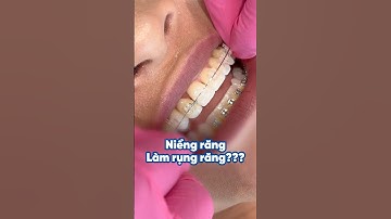 Niềng răng khi mất răng sẽ như thế nào? #nhakhoasing #trending #virals #shorts #niengrang