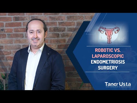 Robotic vs. Laparoscopic Endometriosis Surgery