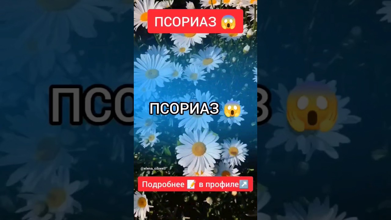 #псориаз #сибирскоездоровье #отзывысибирскоездоровье #еленамихееваsw #siberianwellness