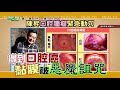 健康2 0 2020 12 2 三 14 00 口腔癌 精彩預告 健康2 0 2020 12 2 三 14 00 口腔癌 精彩預告