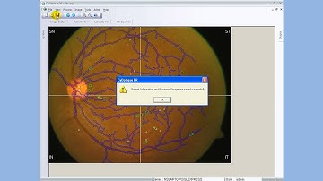 CyOptique - DR - Diabetic Retinopathy Assessment Software