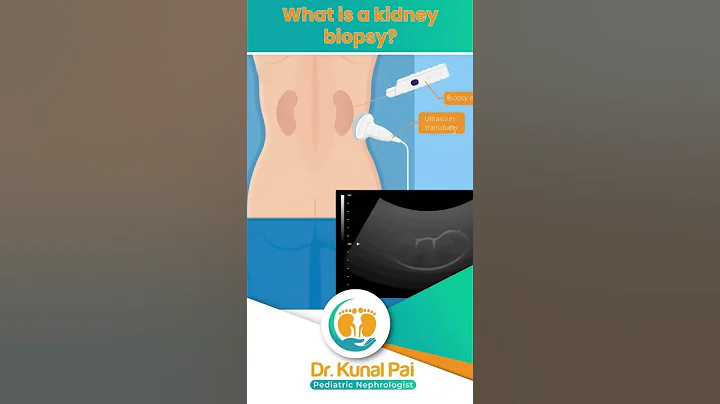 What is a kidney biopsy || Dr Kunal Pai || Pediatric Nephrologist - DayDayNews