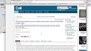 FunctBioinfo2016_Day3pt4_EMT Signaling And iPS vs ES cells-Dusp1 And Erk1