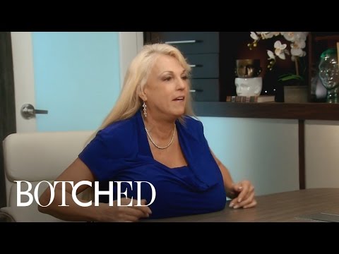 Dr. Terry Dubrow's Hand Gets Crushed By Giant Breast | Botched | E!