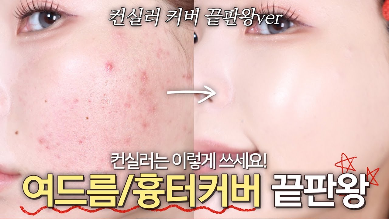⚠️흉터 커버 장인의 여드름 컨실러 끝판왕ver👩🏻‍🏫 컨실러 사용 꿀팁 총정리.zip (팟/팁/브러쉬/커버 무물까지) | 조말랭