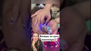😱виниры дома?? Дожили! #омоложение #уколыкрасоты #виниры #губы #увеличениегуб #ботокс #косметология