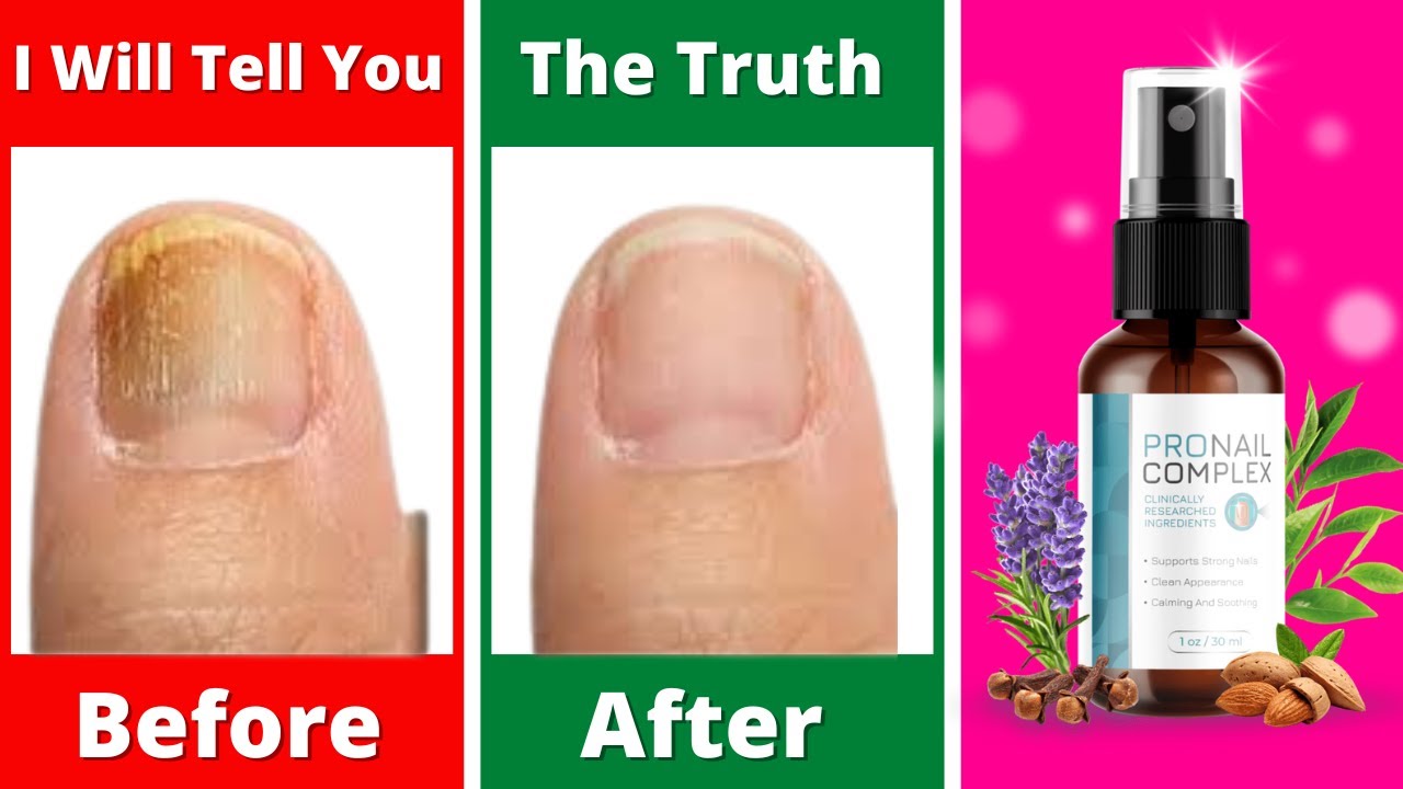 ProNail Complex REVIEW🔴🔴(CHECK BEFORE YOU BUY!!!) – ProNail Complex Reviews – Pro Nail Complex