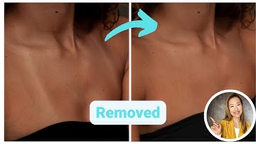 How to remove sun tan marks in Adobe Photoshop